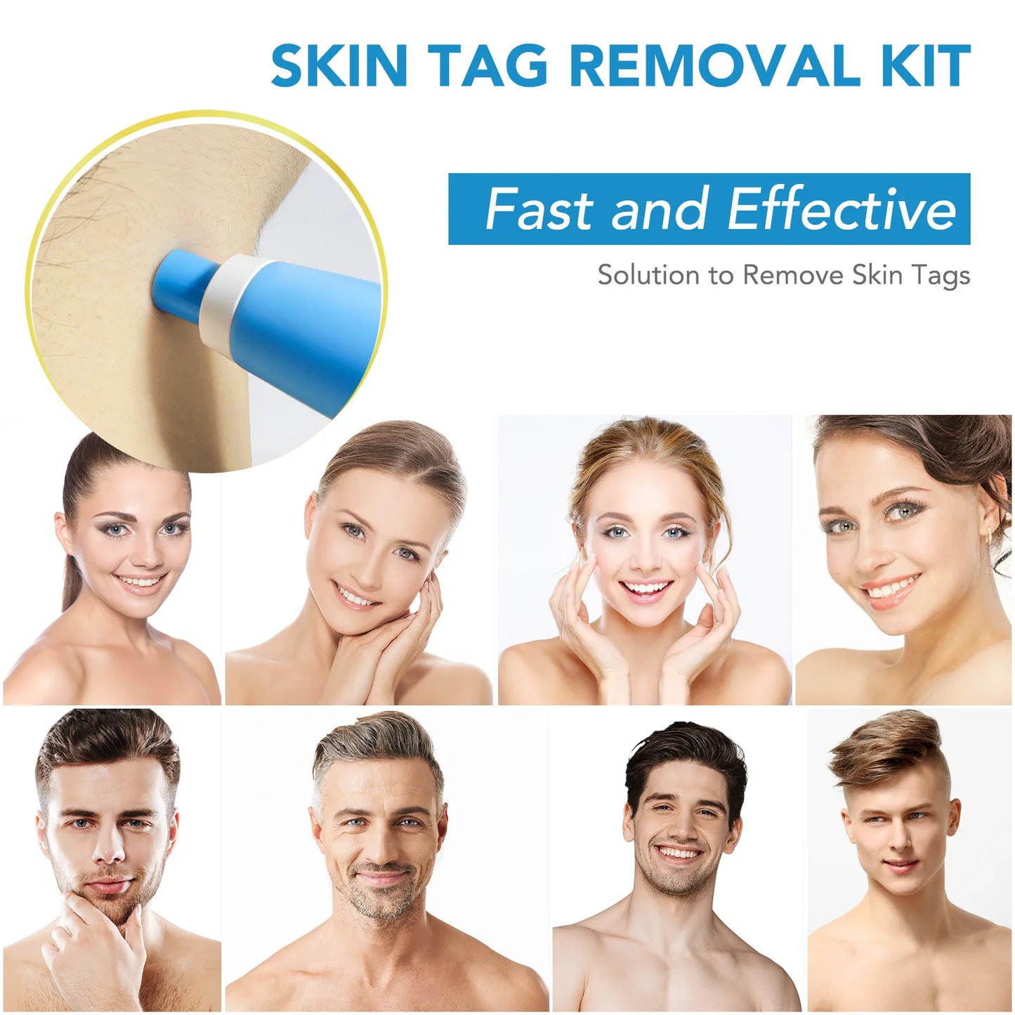 DermaBlu - Kit de Eliminación de Verrugas en Casa